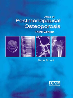 cover image of Atlas of Postmenopausal Osteoporosis